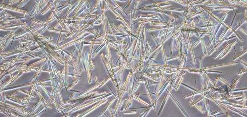 Mikroskopische Aufnahme von Harnsäure-Kristallen